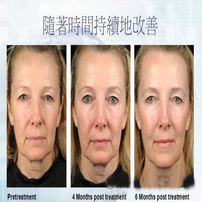 1418379415309442.jpg 未标题-56.jpg