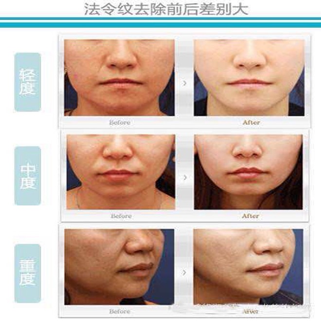 1418379439270886.jpg 未标题-55.jpg